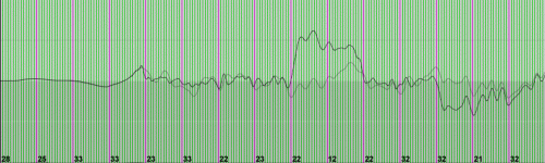 Picture-4.gif